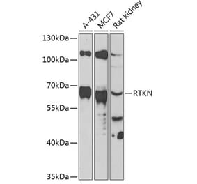 Western Blot - Anti-RTKN Antibody (A90781) - Antibodies.com