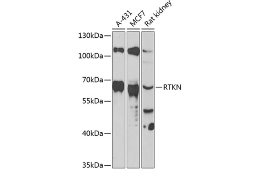 Western Blot - Anti-RTKN Antibody (A90781) - Antibodies.com
