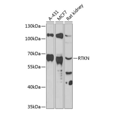 Western Blot - Anti-RTKN Antibody (A90781) - Antibodies.com