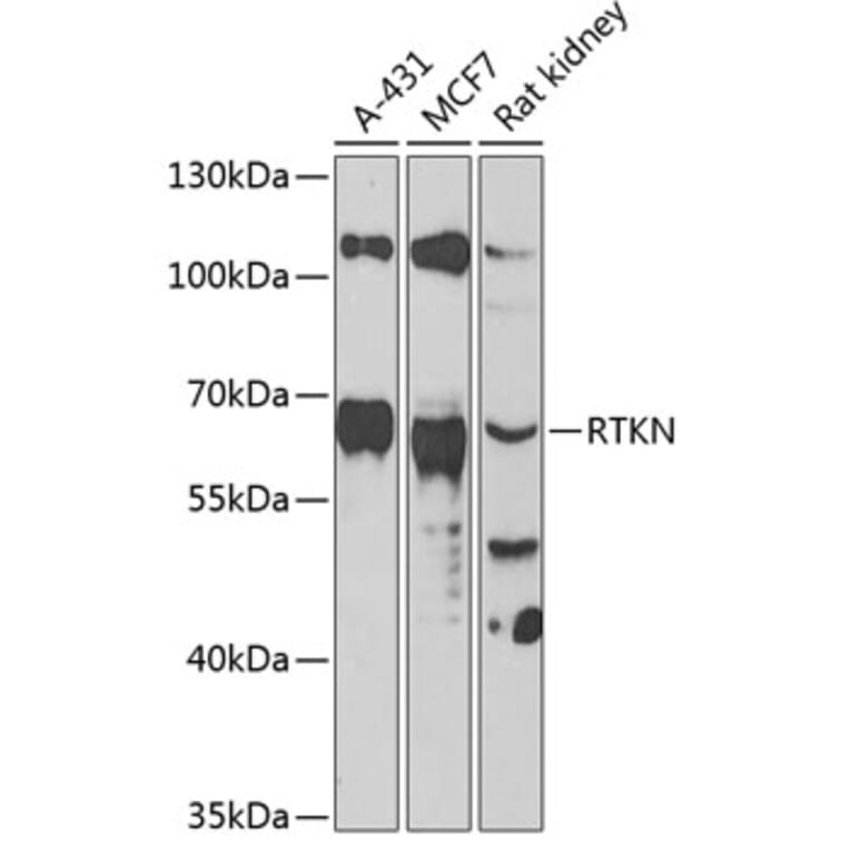 Western Blot - Anti-RTKN Antibody (A90781) - Antibodies.com
