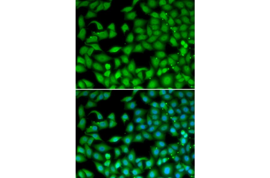 Immunofluorescence - Anti-RTKN Antibody (A90781) - Antibodies.com