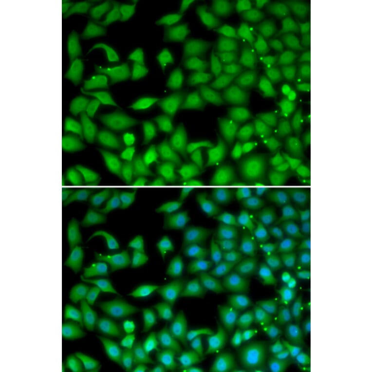 Immunofluorescence - Anti-RTKN Antibody (A90781) - Antibodies.com