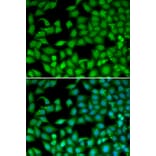 Immunofluorescence - Anti-RTKN Antibody (A90781) - Antibodies.com