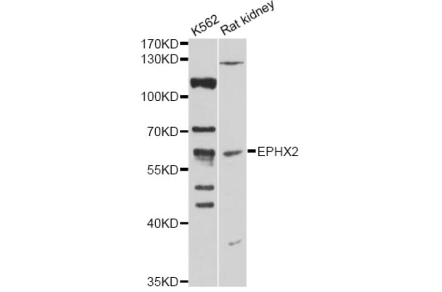 Western Blot - Anti-EPHX2 Antibody (A14203) - Antibodies.com