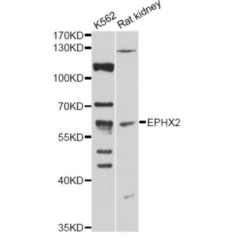 Western Blot - Anti-EPHX2 Antibody (A14203) - Antibodies.com