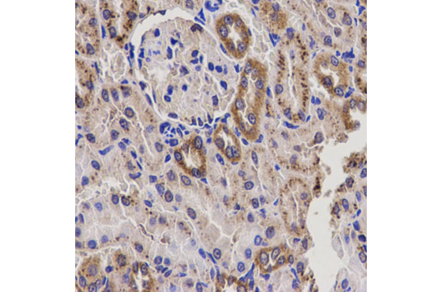 Immunohistochemistry - Anti-EPHX2 Antibody (A14203) - Antibodies.com