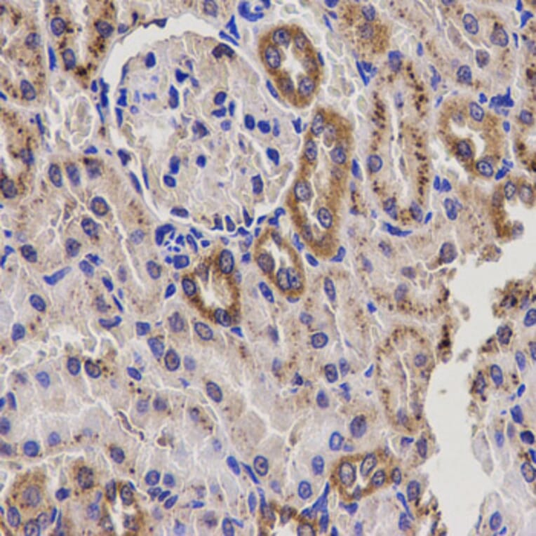 Immunohistochemistry - Anti-EPHX2 Antibody (A14203) - Antibodies.com