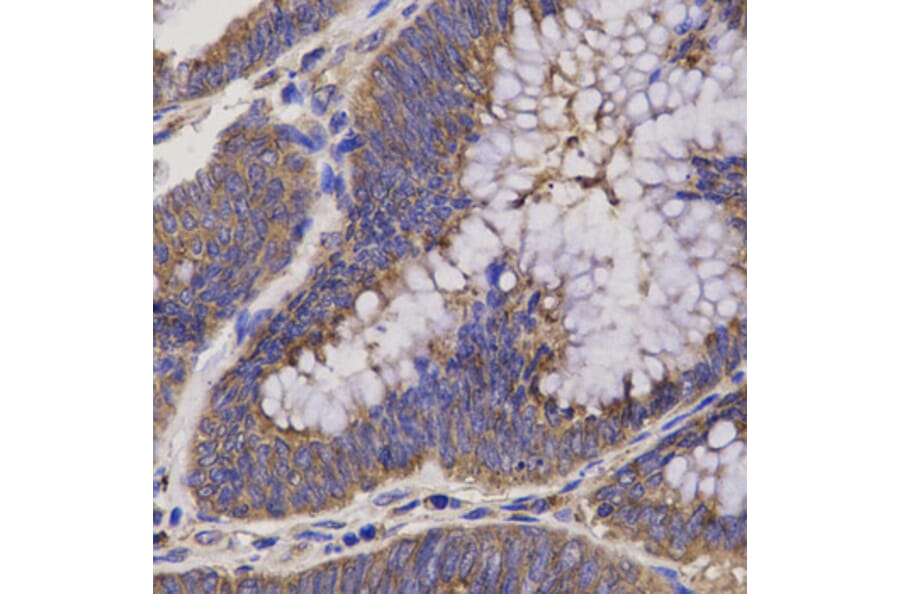 Immunohistochemistry - Anti-EPHX2 Antibody (A14203) - Antibodies.com