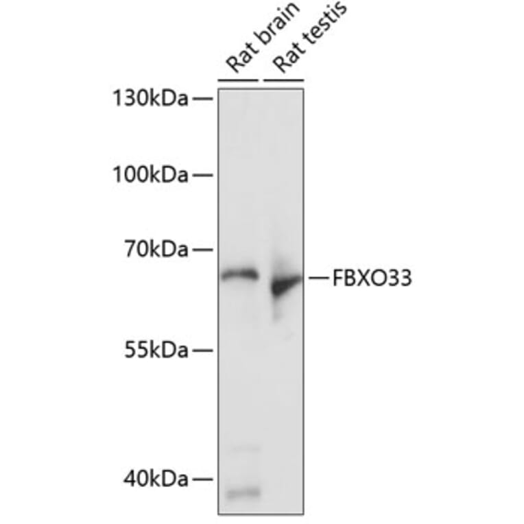 Western Blot - Anti-FBXO33 Antibody (A90784) - Antibodies.com