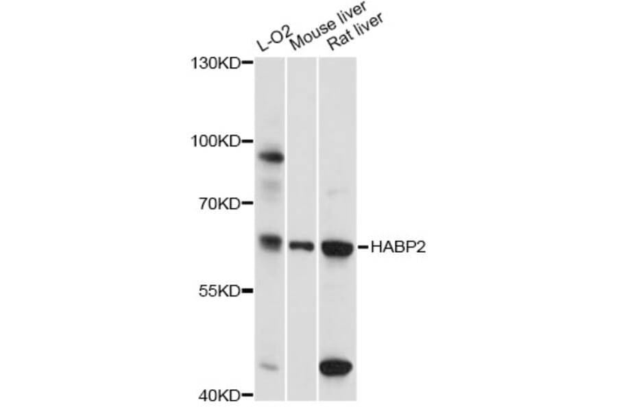 Western Blot - Anti-HABP2 Antibody (A14565) - Antibodies.com