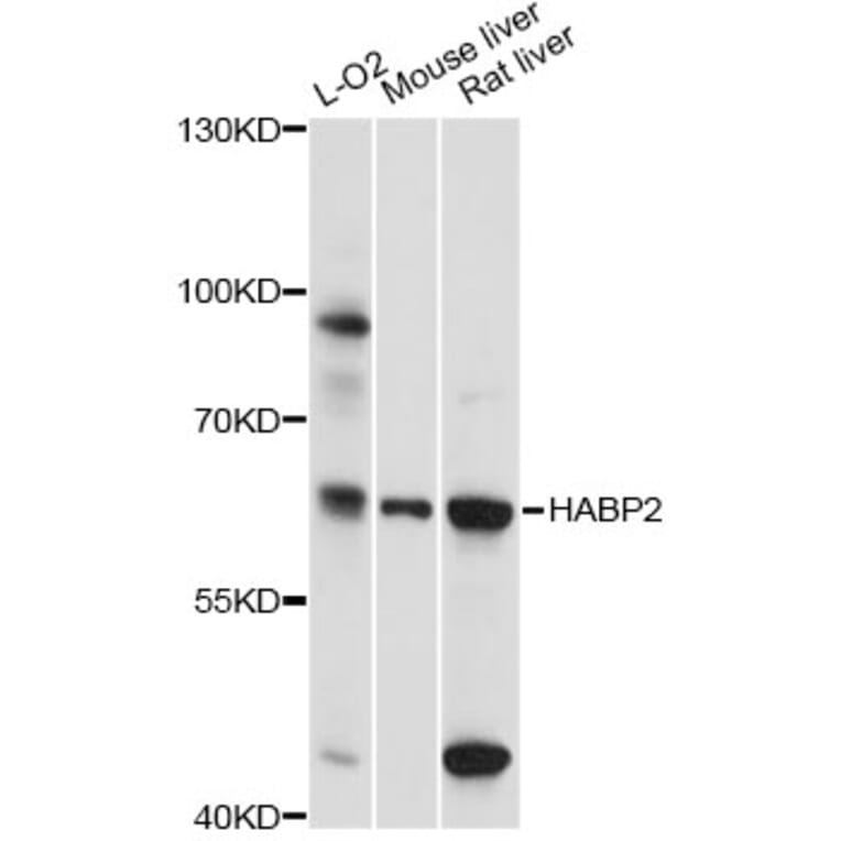 Western Blot - Anti-HABP2 Antibody (A14565) - Antibodies.com