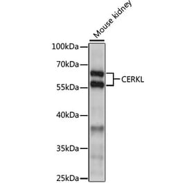 Western Blot - Anti-CERKL Antibody (A90786) - Antibodies.com