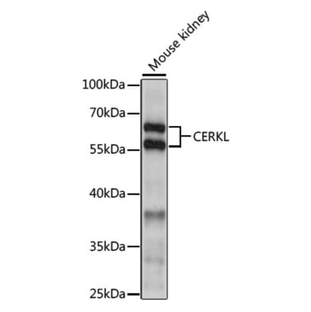 Western Blot - Anti-CERKL Antibody (A90786) - Antibodies.com