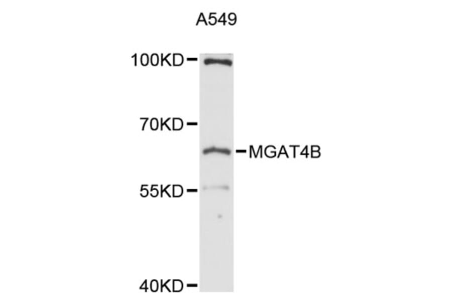 Western Blot - Anti-MGAT4B Antibody (A12810) - Antibodies.com