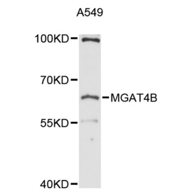 Western Blot - Anti-MGAT4B Antibody (A12810) - Antibodies.com