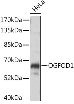 Western blot analysis of extracts of HeLa cells, using Anti-OGFOD1 Antibody (A16543) at 1:1,000 dilution.
Secondary antibody: Goat Anti-Rabbit IgG (H+L) (HRP) (AS014) at 1:10,000 dilution.
Lysates / proteins: 25µg per lane.
Blocking buffer: 3% non-fat dry milk in TBST.
Detection: ECL Basic Kit (RM00020).
Exposure time: 5s.