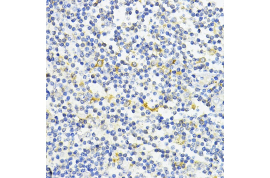 Immunohistochemistry - Anti-AMPK alpha 1 Antibody (A90790) - Antibodies.com