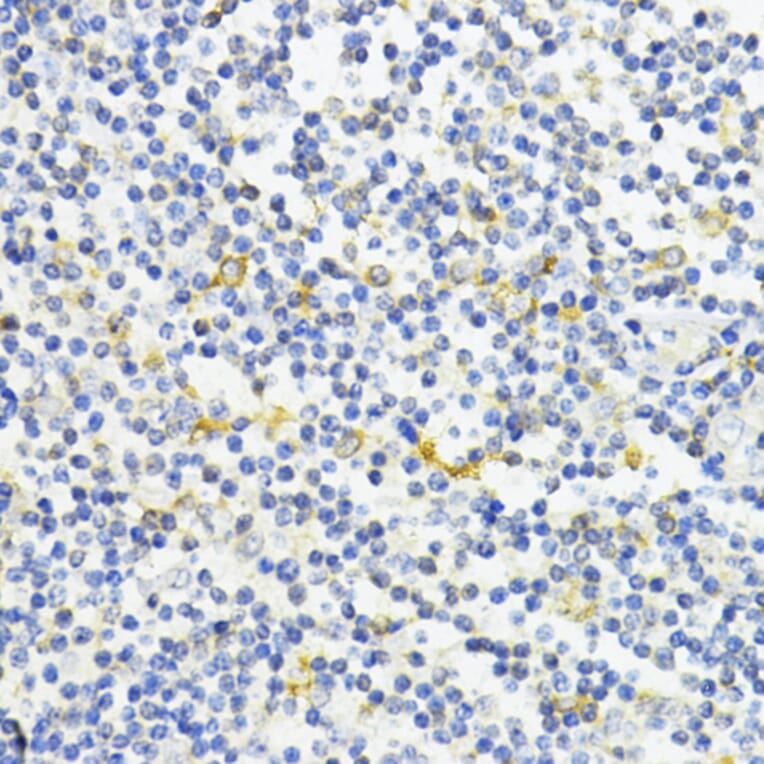 Immunohistochemistry - Anti-AMPK alpha 1 Antibody (A90790) - Antibodies.com