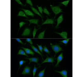 Immunofluorescence - Anti-TRIM45 Antibody (A90791) - Antibodies.com