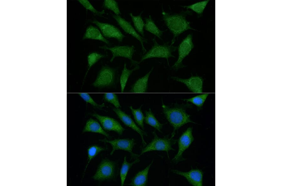 Immunofluorescence - Anti-TRIM45 Antibody (A90791) - Antibodies.com
