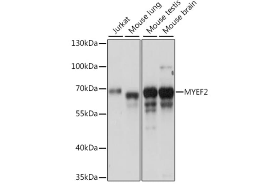 Western Blot - Anti-Myelin expression factor 2 Antibody (A90792) - Antibodies.com