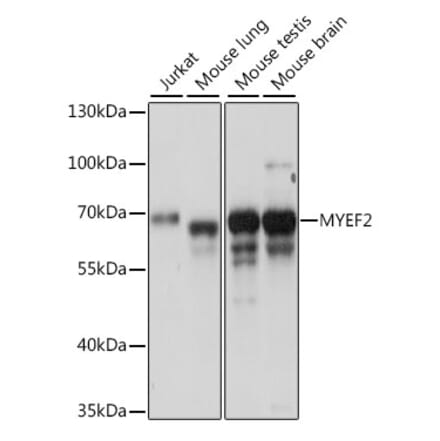 Western Blot - Anti-Myelin expression factor 2 Antibody (A90792) - Antibodies.com