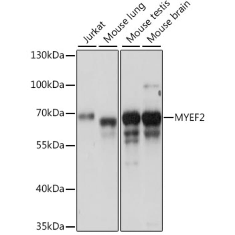Western Blot - Anti-Myelin expression factor 2 Antibody (A90792) - Antibodies.com