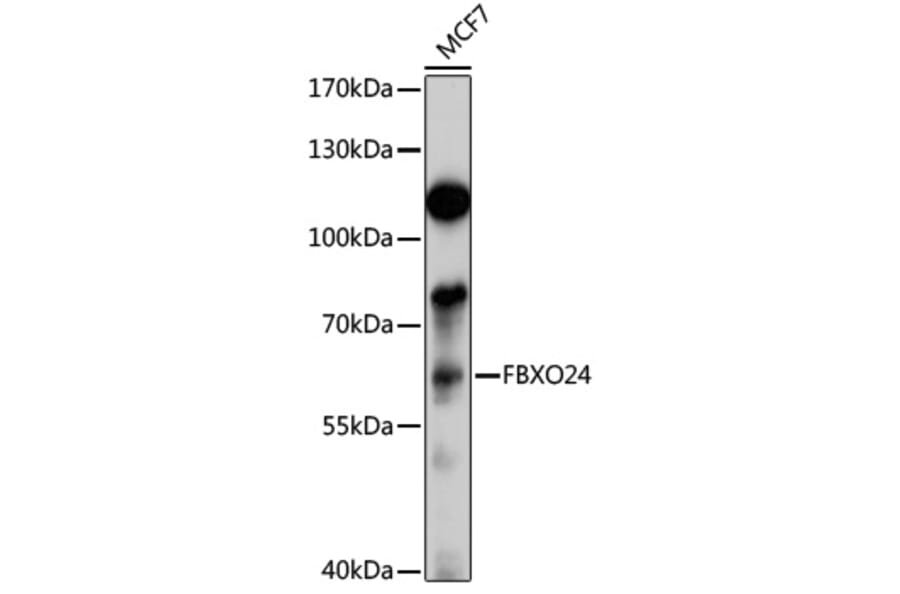 Western Blot - Anti-FBXO24 Antibody (A13770) - Antibodies.com