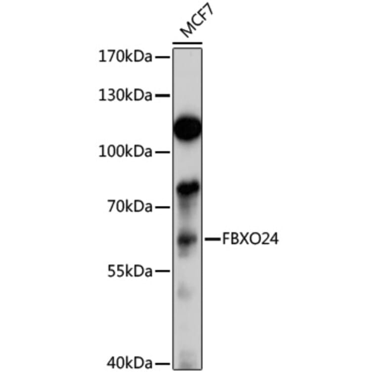 Western Blot - Anti-FBXO24 Antibody (A13770) - Antibodies.com