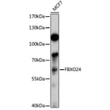 Western Blot - Anti-FBXO24 Antibody (A13770) - Antibodies.com