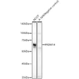 Western Blot - Anti-PRDM14 Antibody (A90794) - Antibodies.com