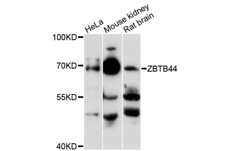 Western Blot - Anti-ZBTB44 Antibody (A13148) - Antibodies.com