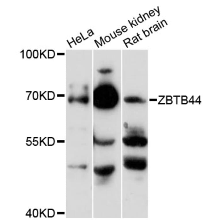 Western Blot - Anti-ZBTB44 Antibody (A13148) - Antibodies.com