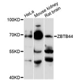 Western Blot - Anti-ZBTB44 Antibody (A13148) - Antibodies.com
