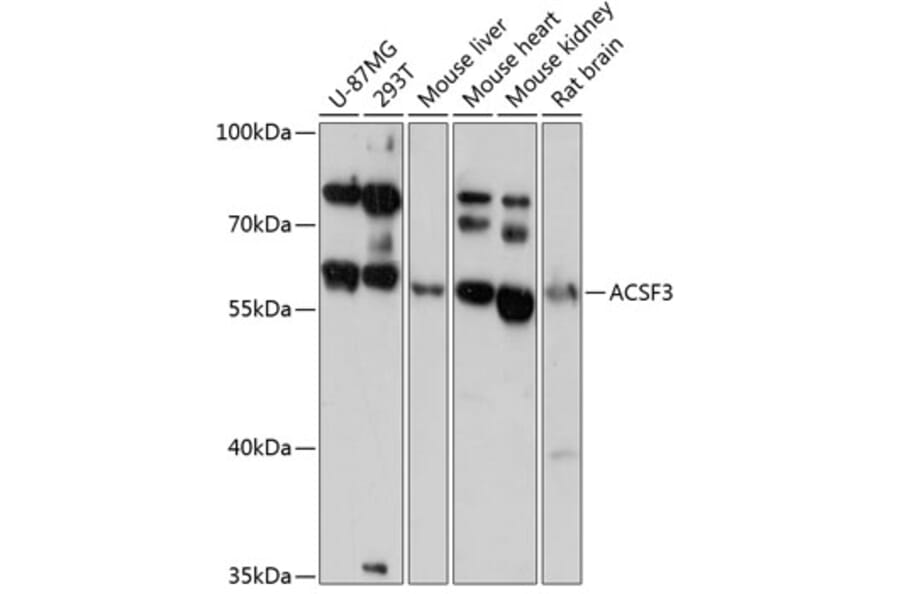 Western Blot - Anti-ACSF3 Antibody (A90796) - Antibodies.com