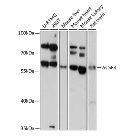 Western Blot - Anti-ACSF3 Antibody (A90796) - Antibodies.com