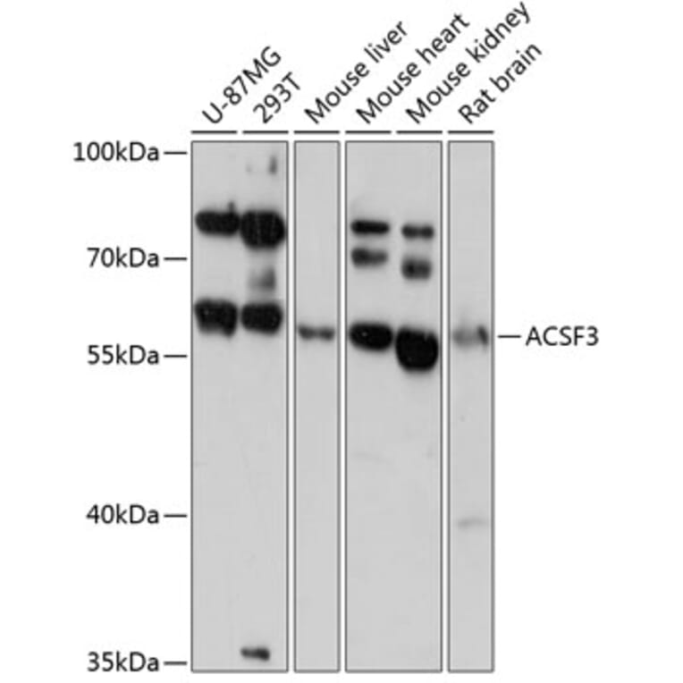 AntiACSF3 Antibody (A90796)