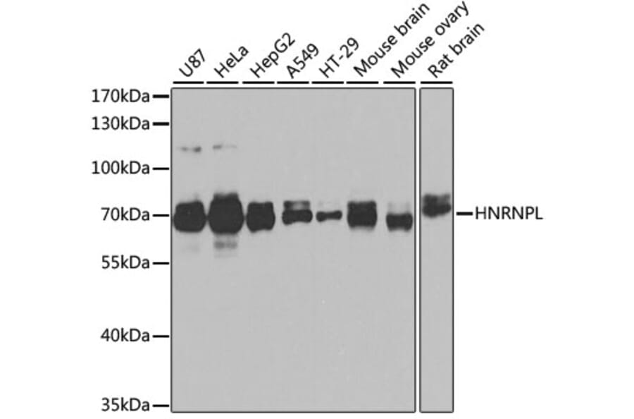 Western Blot - Anti-hnRNP L Antibody (A90797) - Antibodies.com
