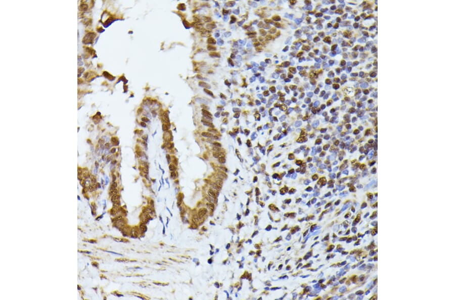 Immunohistochemistry - Anti-hnRNP L Antibody (A90797) - Antibodies.com
