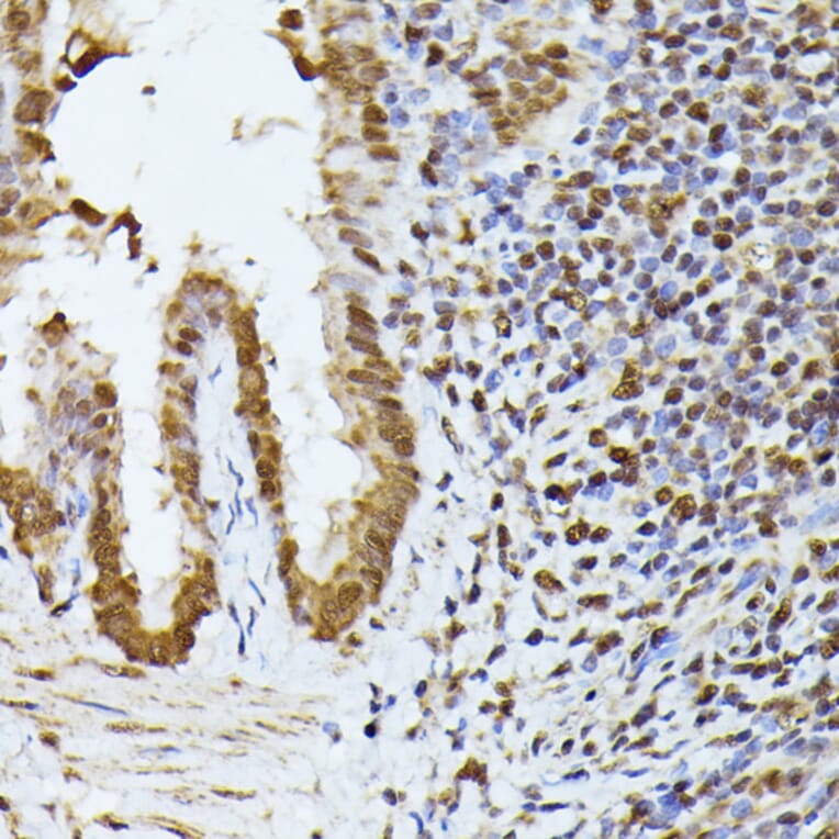 Immunohistochemistry - Anti-hnRNP L Antibody (A90797) - Antibodies.com