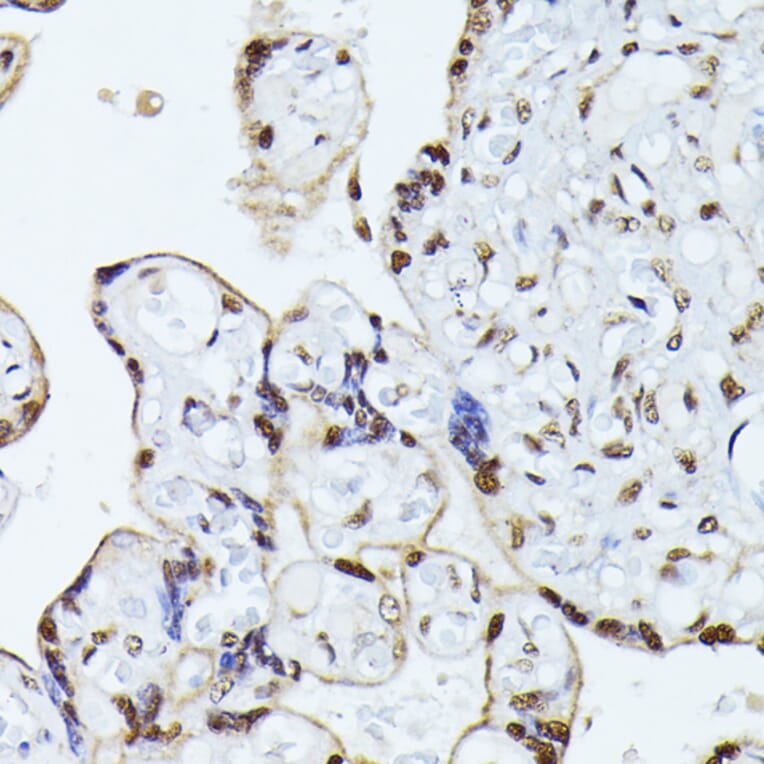 Immunohistochemistry - Anti-hnRNP L Antibody (A90797) - Antibodies.com