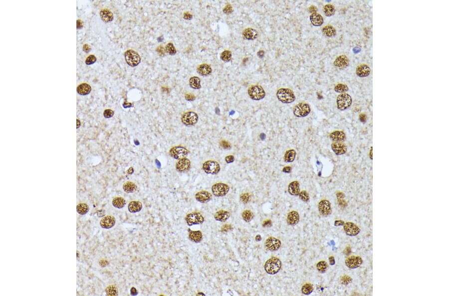 Immunohistochemistry - Anti-hnRNP L Antibody (A90797) - Antibodies.com