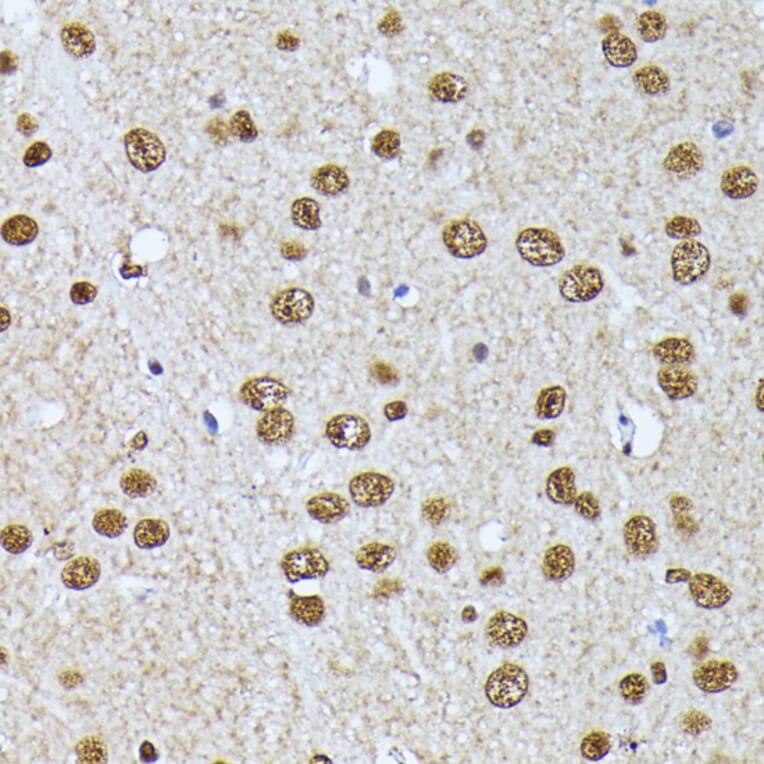 Immunohistochemistry - Anti-hnRNP L Antibody (A90797) - Antibodies.com