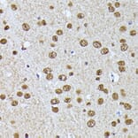 Immunohistochemistry - Anti-hnRNP L Antibody (A90797) - Antibodies.com