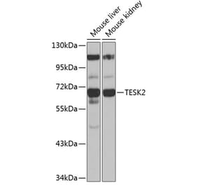 Western Blot - Anti-TESK2 Antibody (A90798) - Antibodies.com