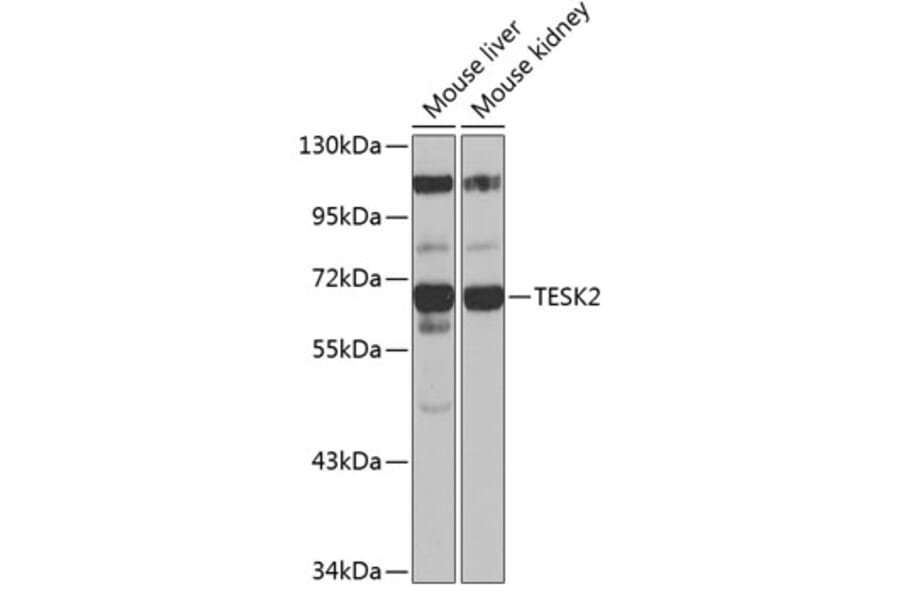 Western Blot - Anti-TESK2 Antibody (A90798) - Antibodies.com