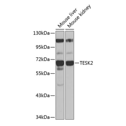 Western Blot - Anti-TESK2 Antibody (A90798) - Antibodies.com