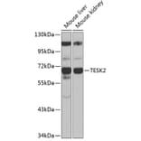 Western Blot - Anti-TESK2 Antibody (A90798) - Antibodies.com