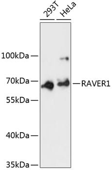 Western blot analysis of extracts of various cell lines, using Anti-RAVER1 Antibody (A13138) at 1:3000 dilution.
Secondary antibody: Goat Anti-Rabbit IgG (H+L) (HRP) (AS014) at 1:10,000 dilution.
Lysates / proteins: 25µg per lane.
Blocking buffer: 3% non-fat dry milk in TBST.
Detection: ECL Basic Kit (RM00020).
Exposure time: 90s.