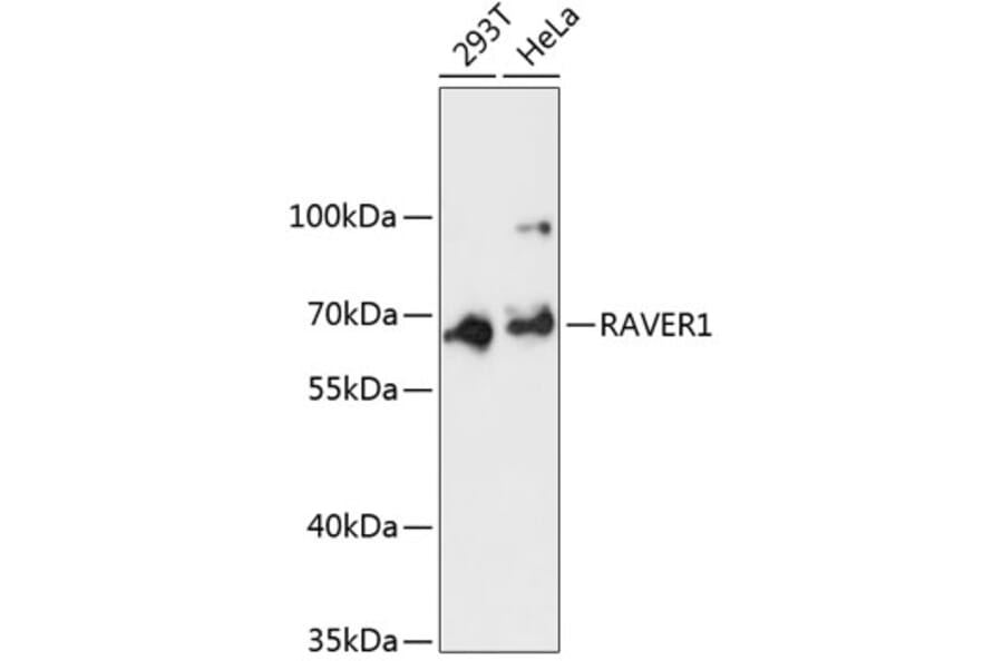 Western Blot - Anti-RAVER1 Antibody (A90799) - Antibodies.com